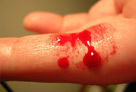 تحليل سيولة الدم-معامل طيبة